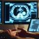radiologist reviewing Eon AI flagged incidental findings