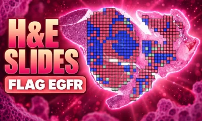 Lunit H&E slides flag EGFR at WCLC Seoul