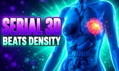 NYU serial 3D mammograms beat density breast risk