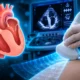 Mayo AI flags HCM obstruction on resting ultrasound