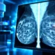 NYU-DRP serial 3D mammograms five-year AUC 0.721